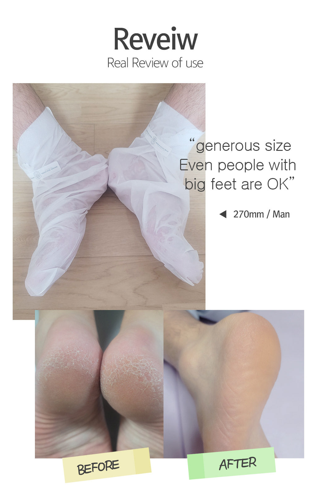 CHAMOS ACACI - Snail Repair Moisturizing Foot Pack 1pz