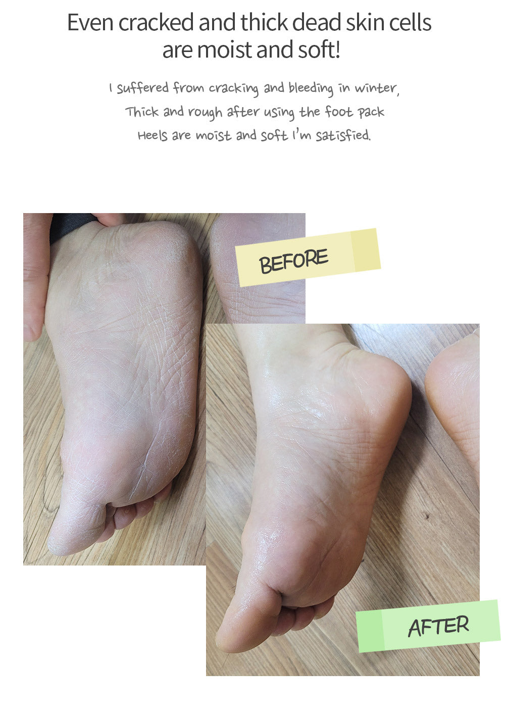 CHAMOS ACACI - Snail Repair Moisturizing Foot Pack 1pz