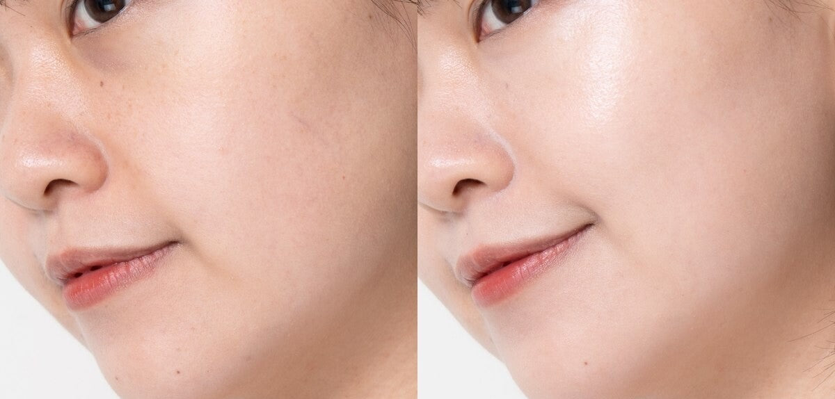 DEWYTREE - The Clean Lab Derma Ceramide Oil Serum 30ml